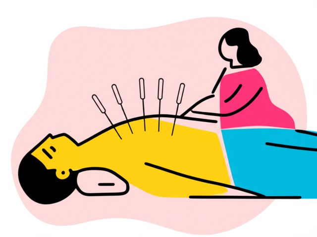 Image representing Acupuncture